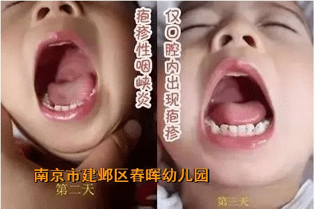 附件：3.png
